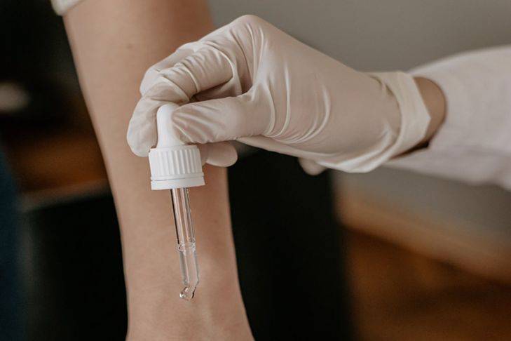 Местное нанесение кантаридина для лечения контагиозного моллюска