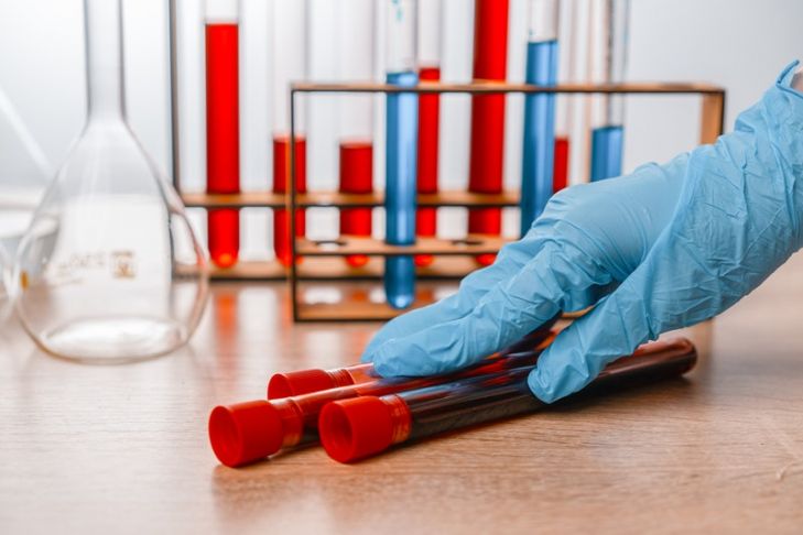 Клінічні та серологічні предиктори рецидиву пухирчатки