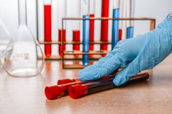 Клінічні та серологічні предиктори рецидиву пухирчатки