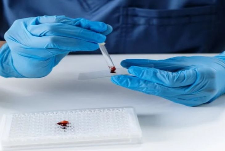 Оптимізація підходів до лікування пацієнтів з меланомою шляхом інтеграції клінічних ознак і генного профілю