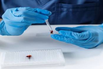 Оптимізація підходів до лікування пацієнтів з меланомою шляхом інтеграції клінічних ознак і генного профілю