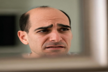 Вибір оптимального дозування міноксидилу при андрогенній алопеції у чоловіків